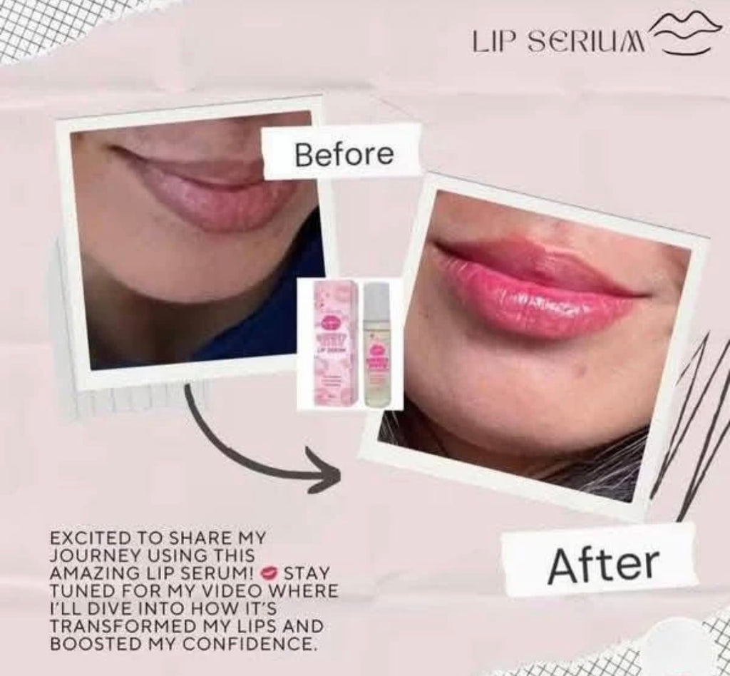 K Beauty Sweet Kiss Lip Serum