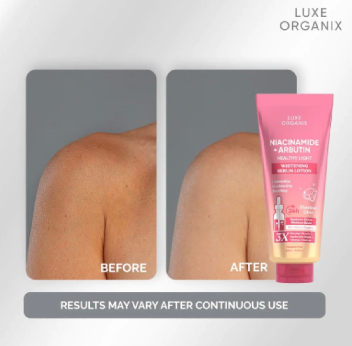 Luxe Organix Niacinamide + Arbutin Whitening Serum Lotion